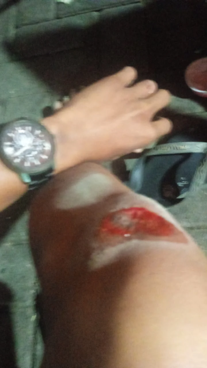 TERJADI KEMBALI PEMBEGALAN KENDARAAN BERMOTOR DI JALAN RESIDEN HAJANUDIN.
SEORANG WARTAWAN MENJADI KORBAN PEMBEGALAN KENDARAAN BERMOTOR,R2