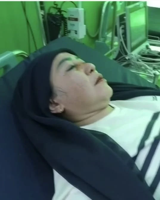 *Kebal Hukum, Ditetapkan Jadi Tersangka Kasus Penganiayaan, Mantan Asisten III Lampura Tidak Ditahan*