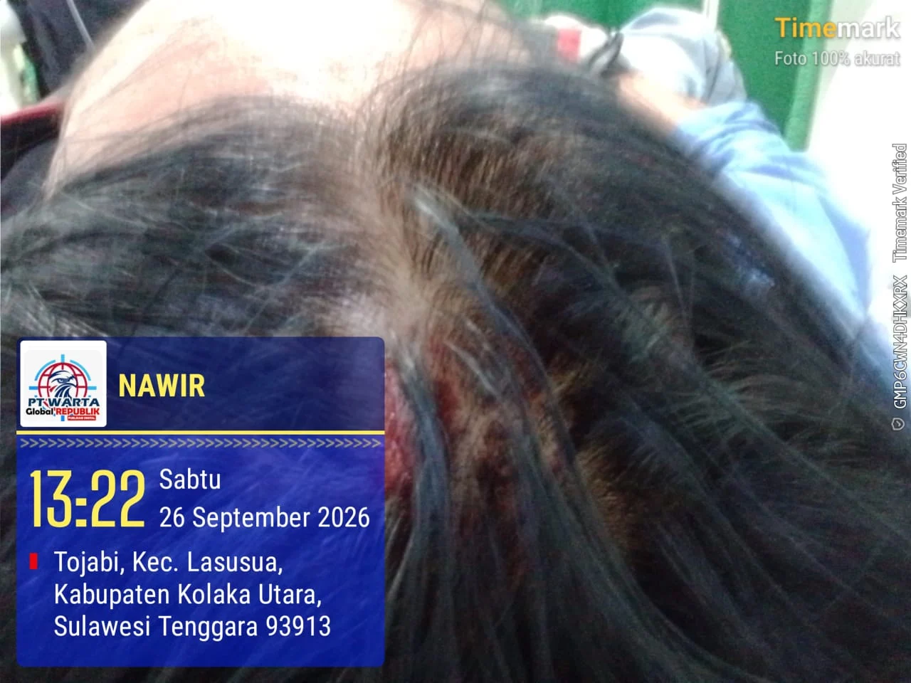 Prof. Dr. Sutan Nasomal: Minta Dewan Pers Mengawal Pemukulan Wartawan di Kolut - Tak Boleh Didiamkan! KAPOLRI & KAPOLDA SULTRA DIMINTA TURUN TANGAN!